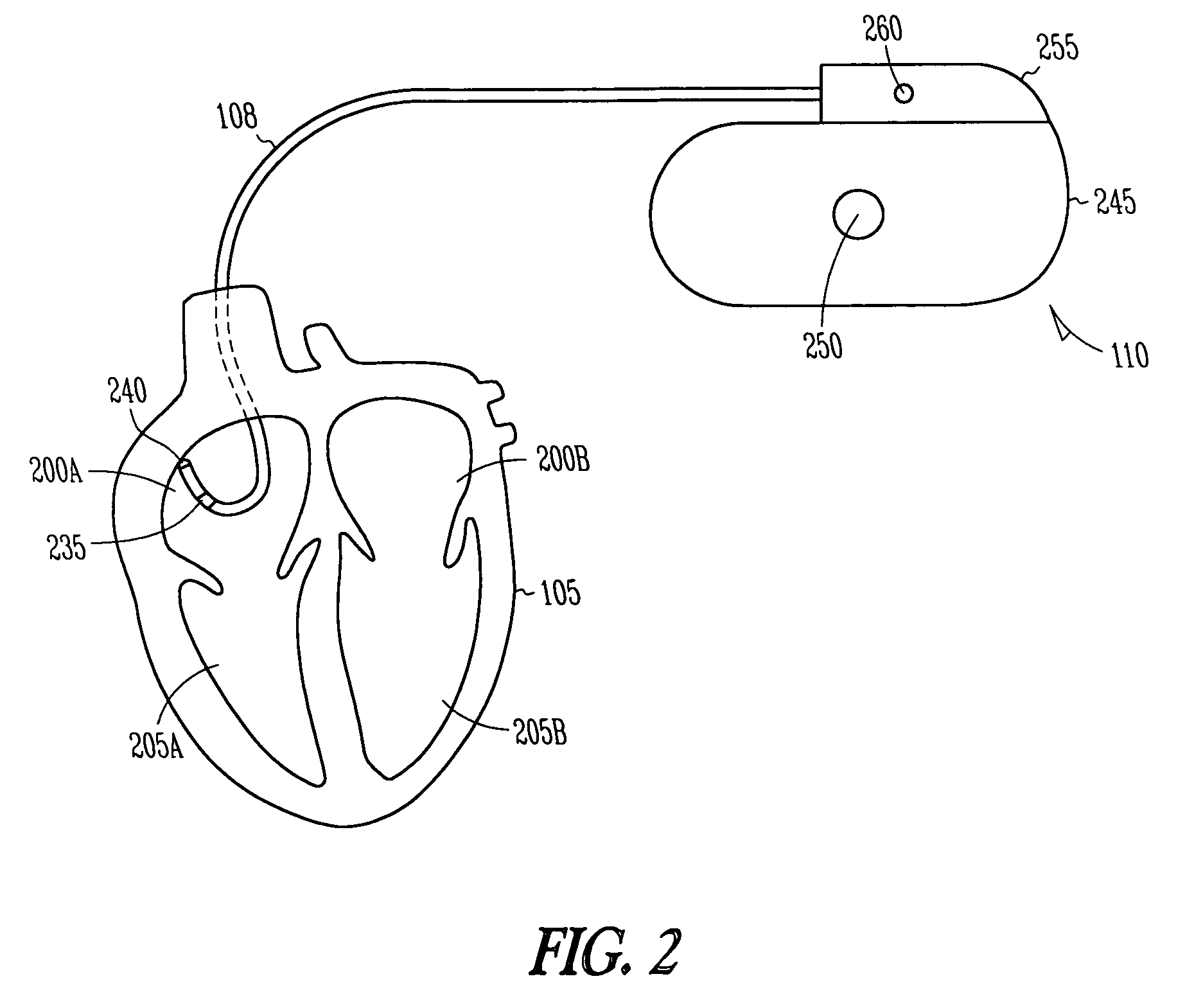 Cardiac stimulation device for sinus rate modulation