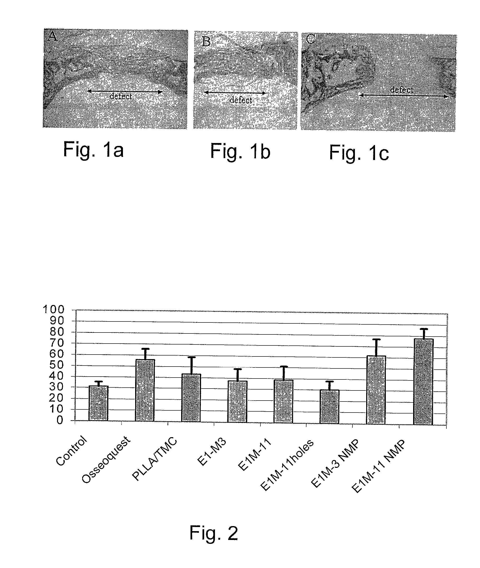 Resorbable polymer composition, implant and method of making implant