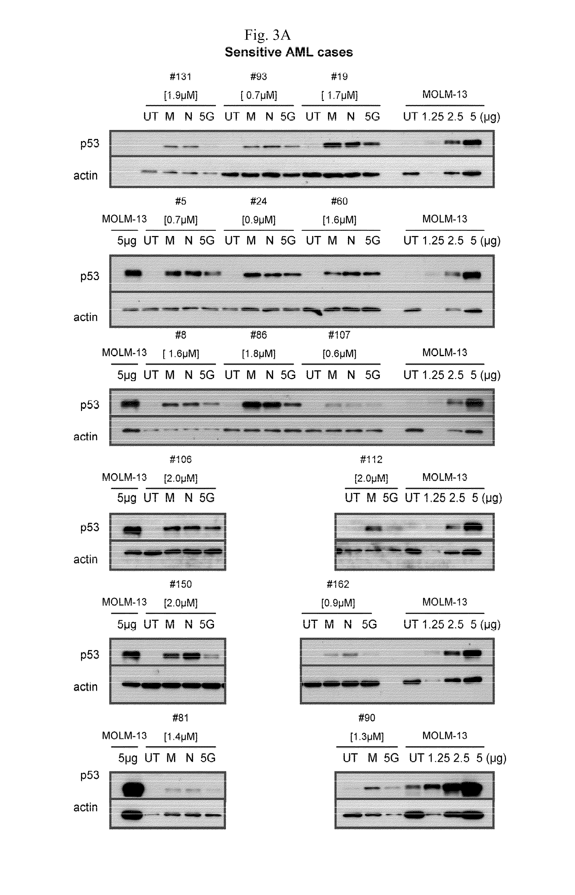 Biomarkers for mdm2 inhibitors for use in treating disease