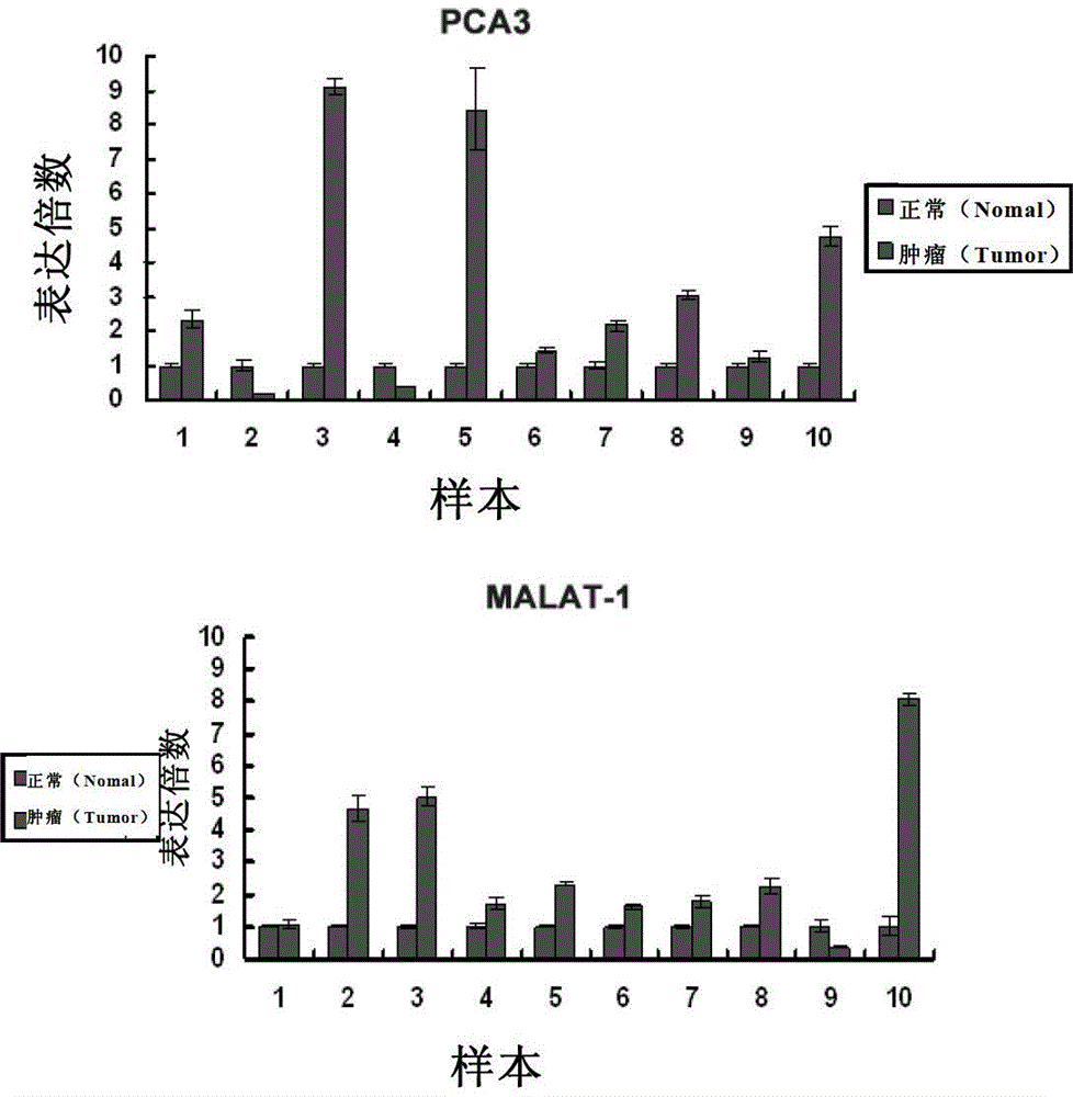 Application of long-chain non-coding RNA as blood molecular marker for disease diagnosis