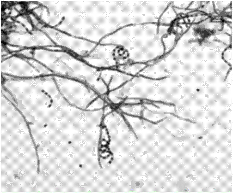 Preparation method of biocontrol microbial agent for controlling apple tree fungal diseases