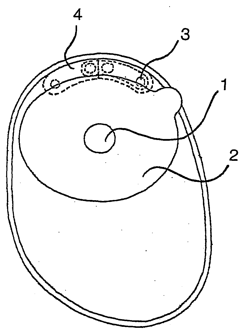 Ostomy appliance