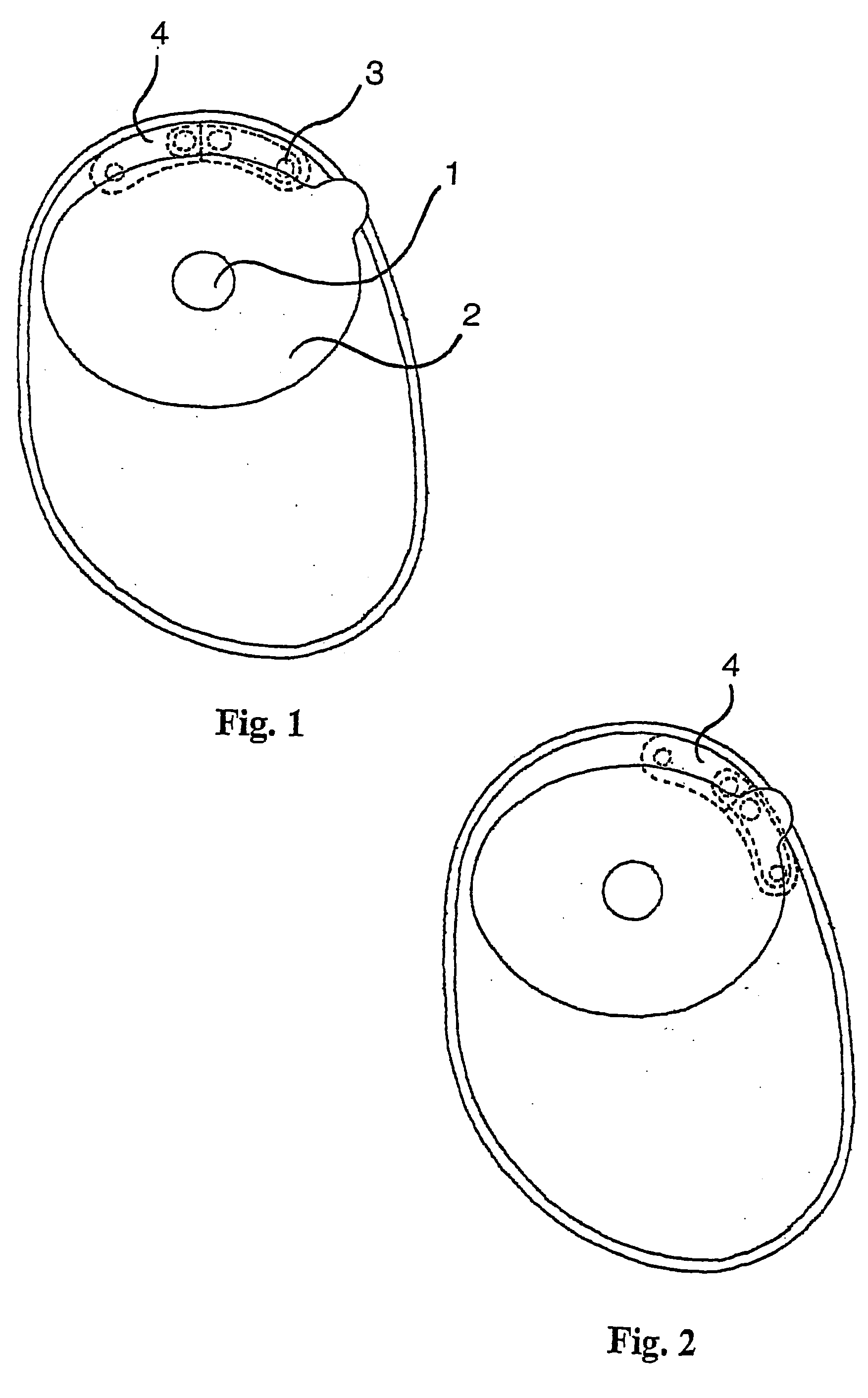 Ostomy appliance