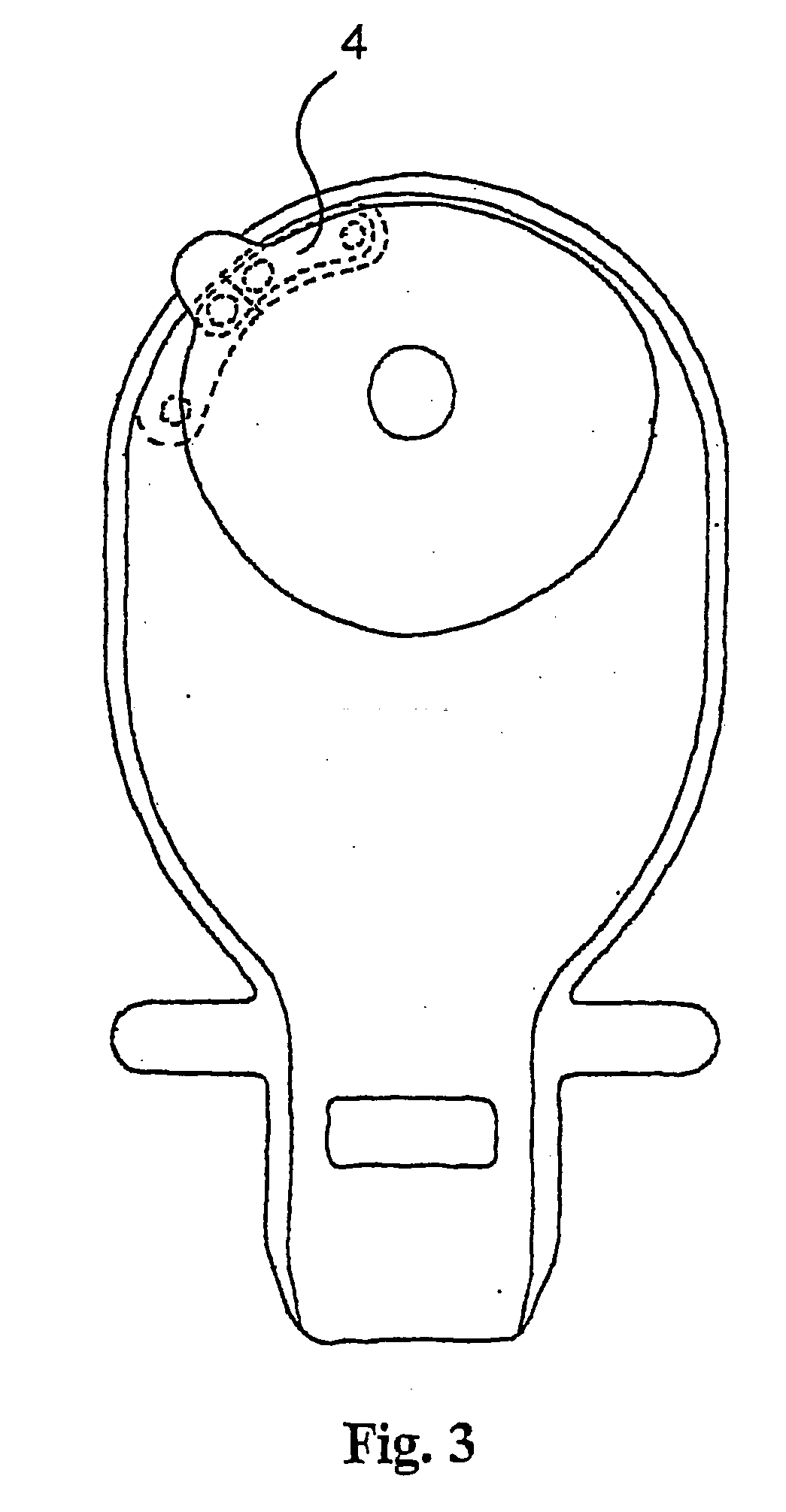 Ostomy appliance