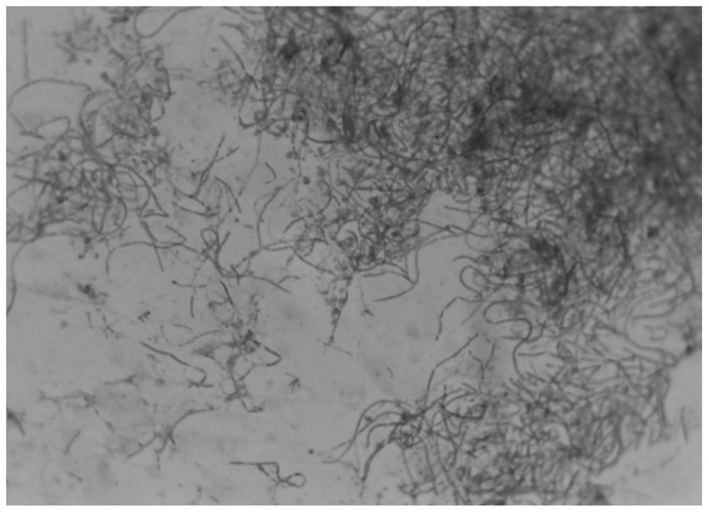 Microbial mixed inoculant for promoting soybean growth and application thereof