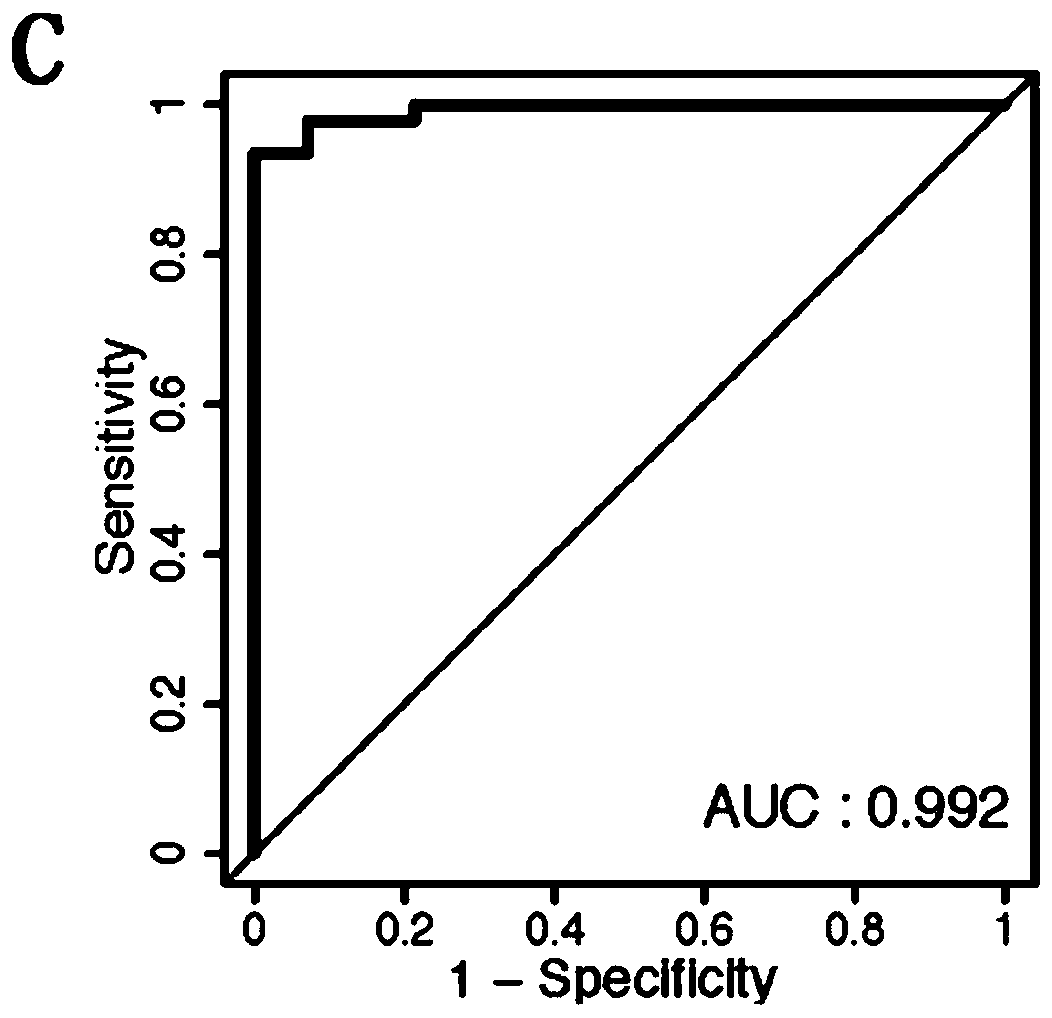 Plasma exosome miRNA molecular marker and application thereof in preparation kit