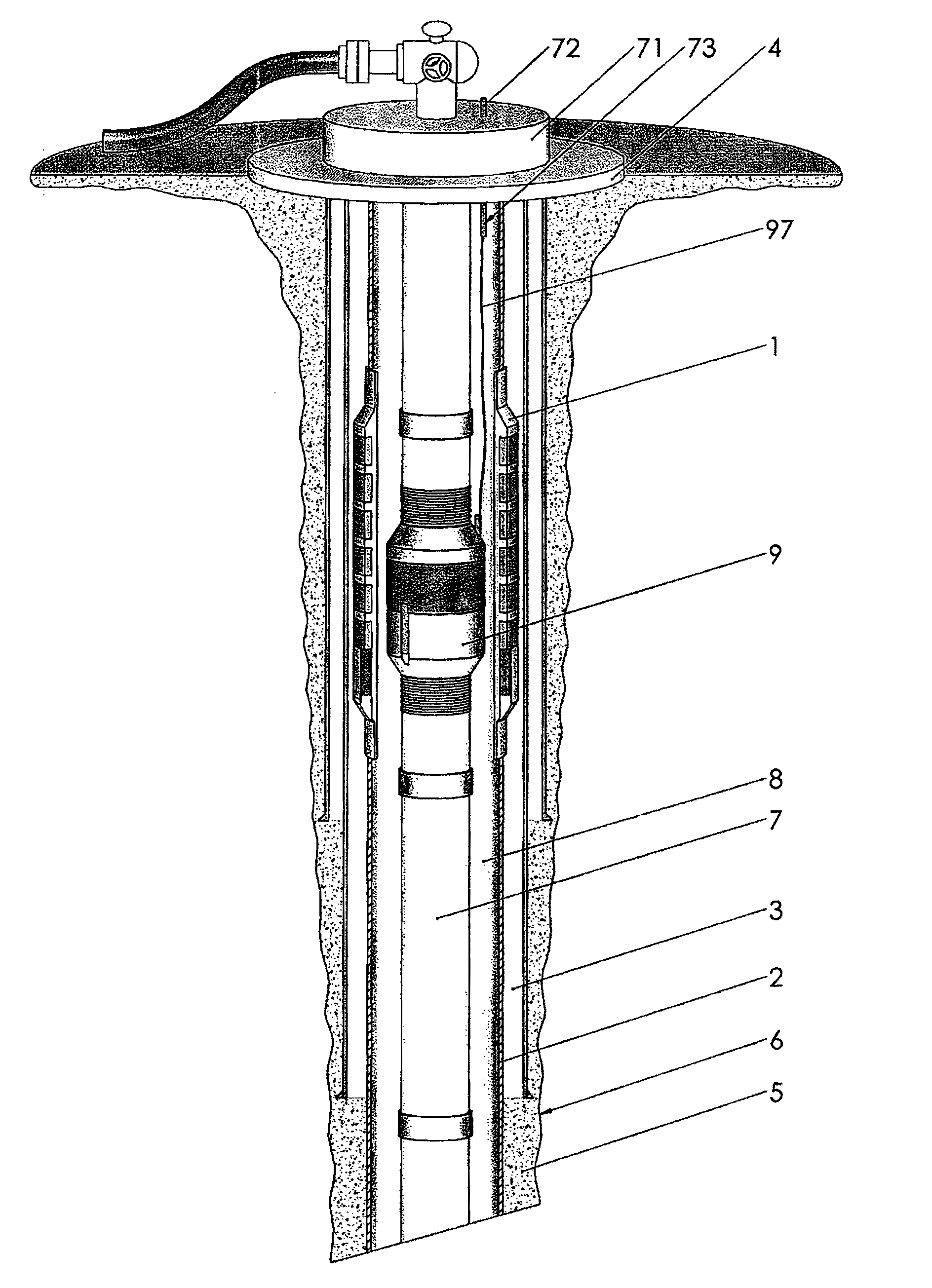 Pressure management system for well casing annuli