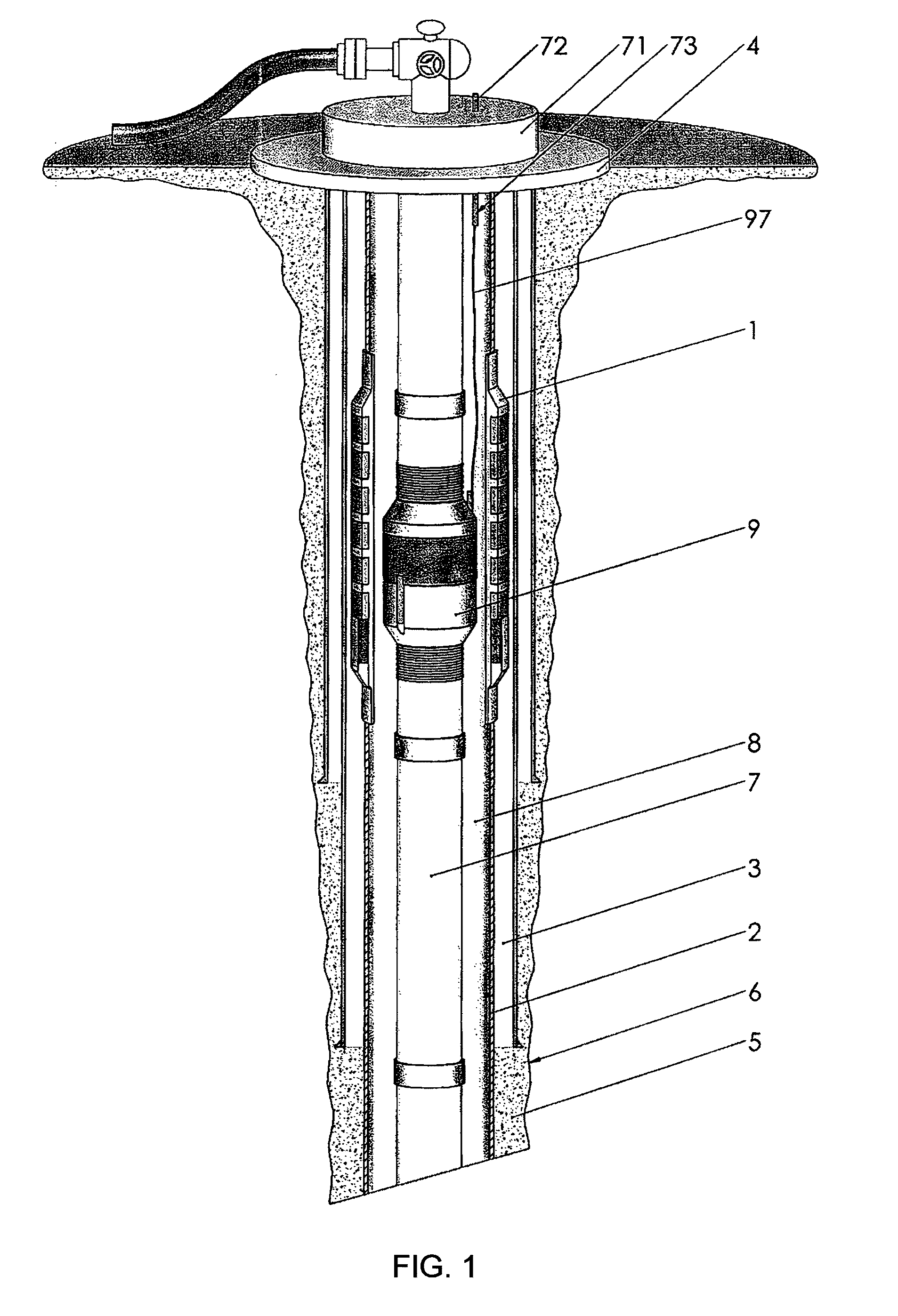 Pressure management system for well casing annuli