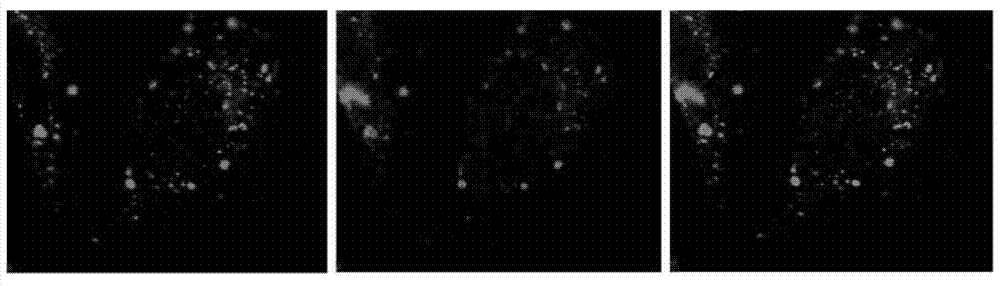 Application of polypeptide in preparation of medicines for treating or preventing metabolic syndrome