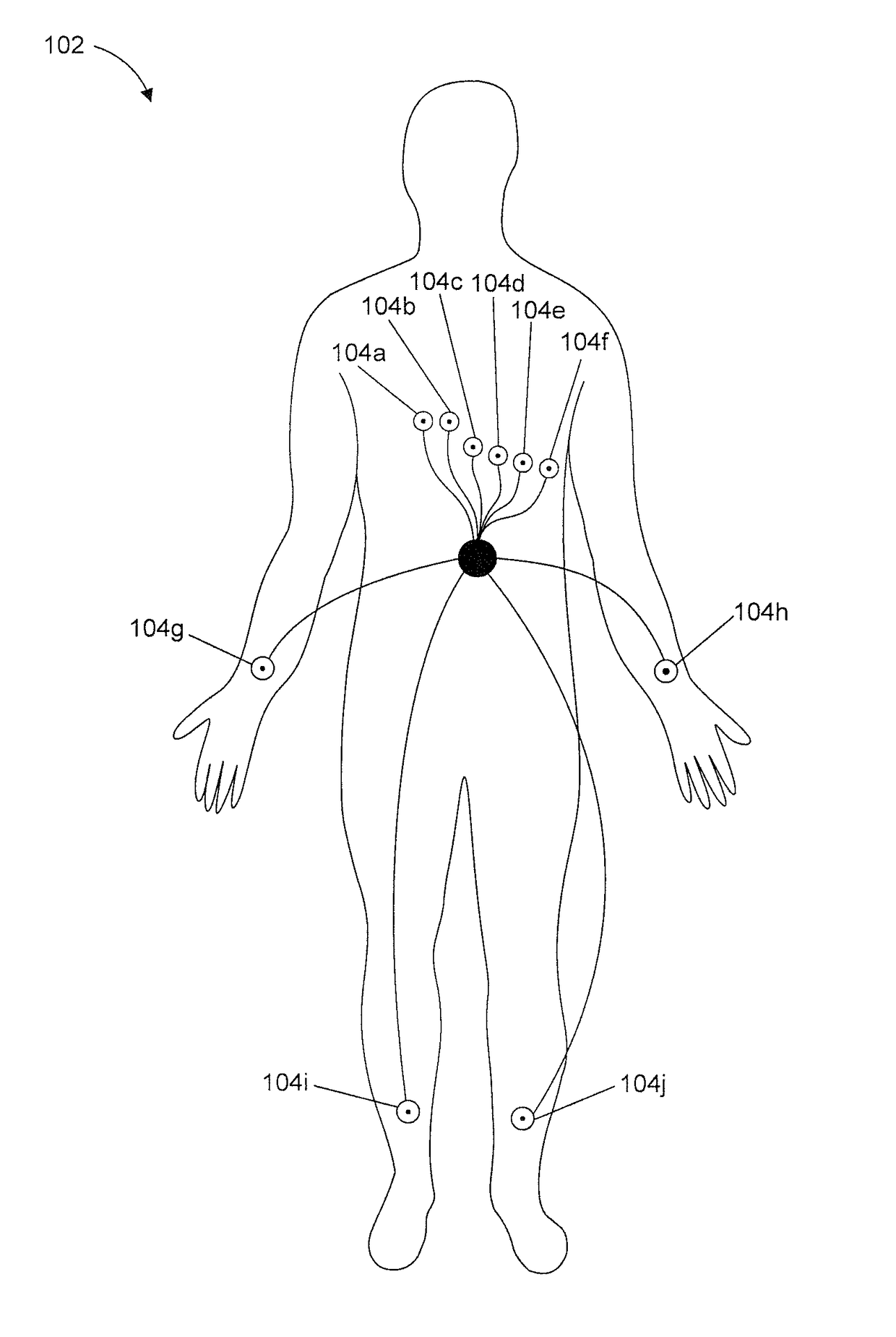 High throughput arrhythmia risk assessment using multilead residua signals