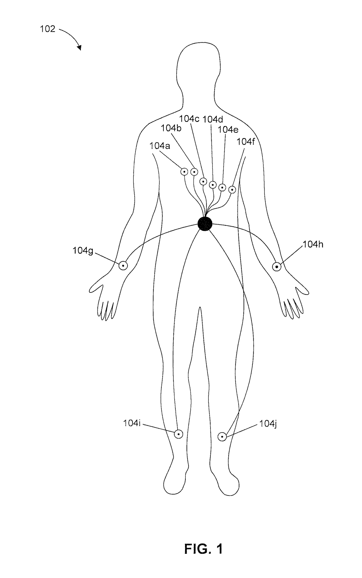 High throughput arrhythmia risk assessment using multilead residua signals