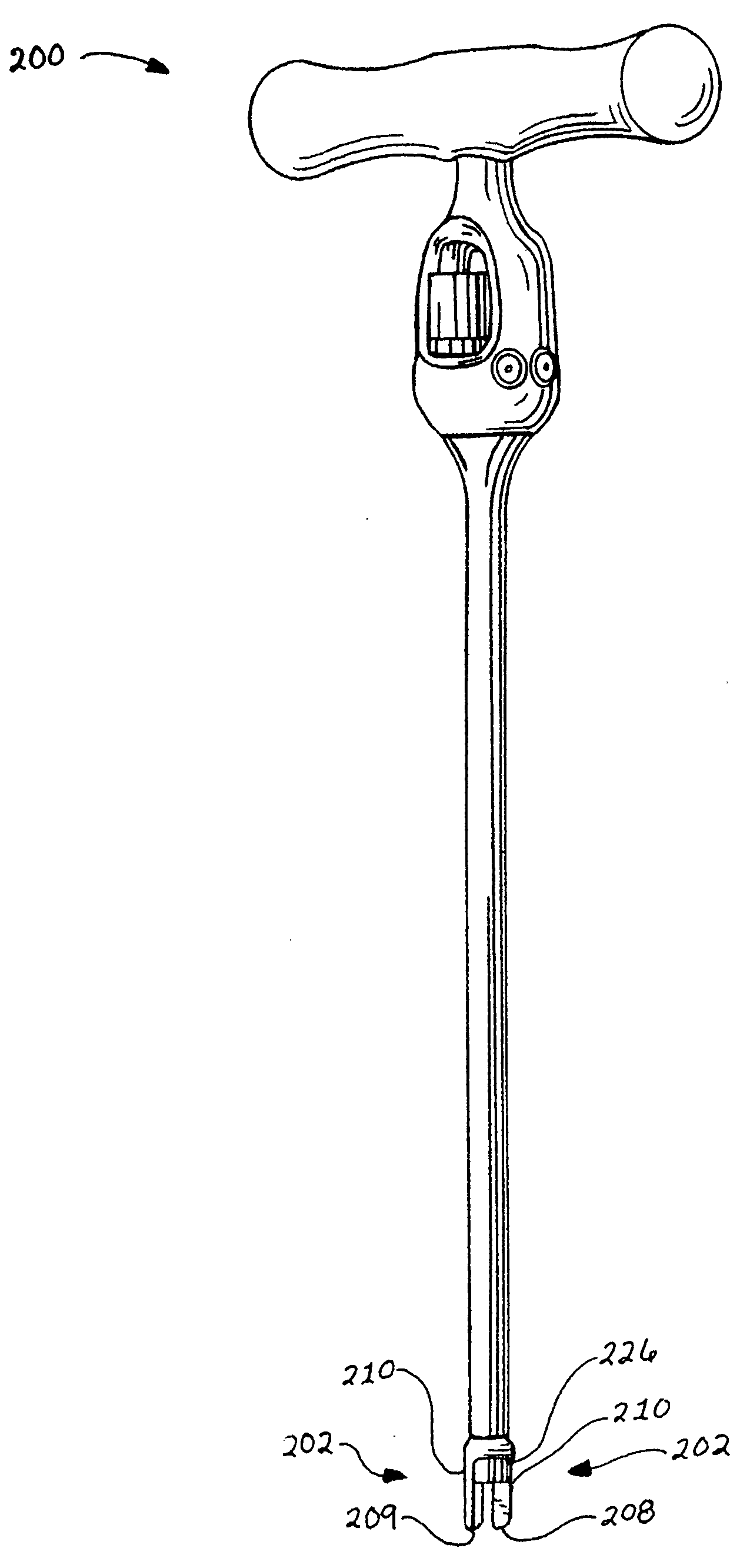 Spinal stabilization device and methods