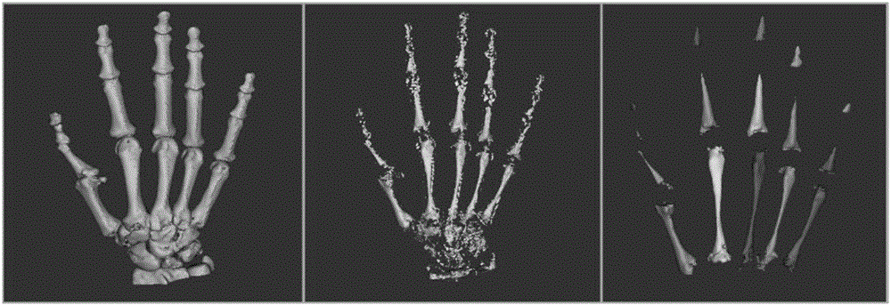 Preparation method of artificial finger joint prosthesis