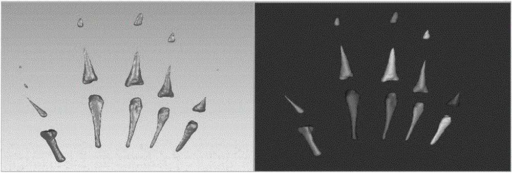 Preparation method of artificial finger joint prosthesis