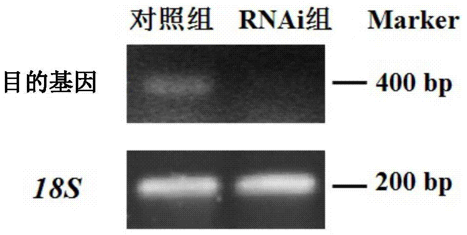 A nucleic acid molecule for interfering with the male reproduction of Macrobrachium rosenbergii and its preparation method