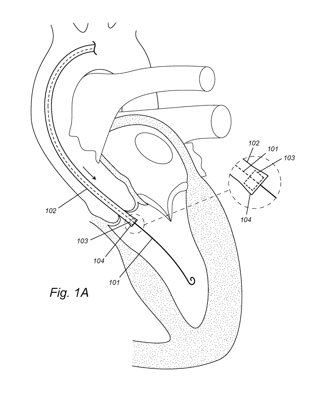 Devices, systems, and methods to optimize annular orientation of transcatheter valves