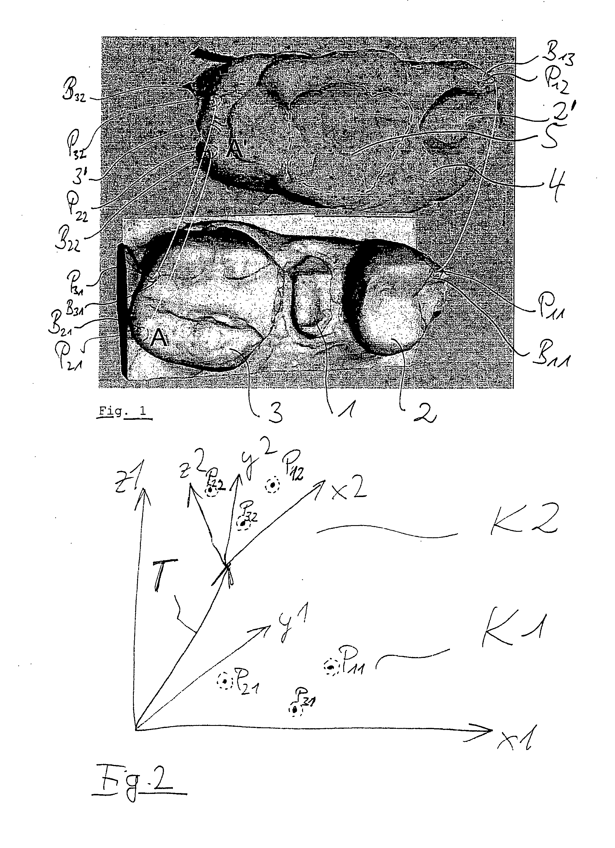 Method for obtaining a position match of 3D data sets in a dental CAD/CAM system