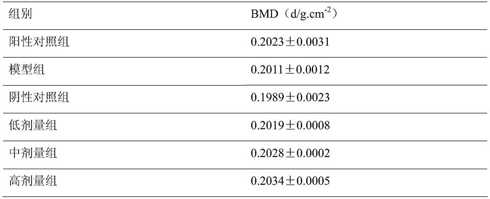 Application of nattokinase to medicine for treating osteoporosis