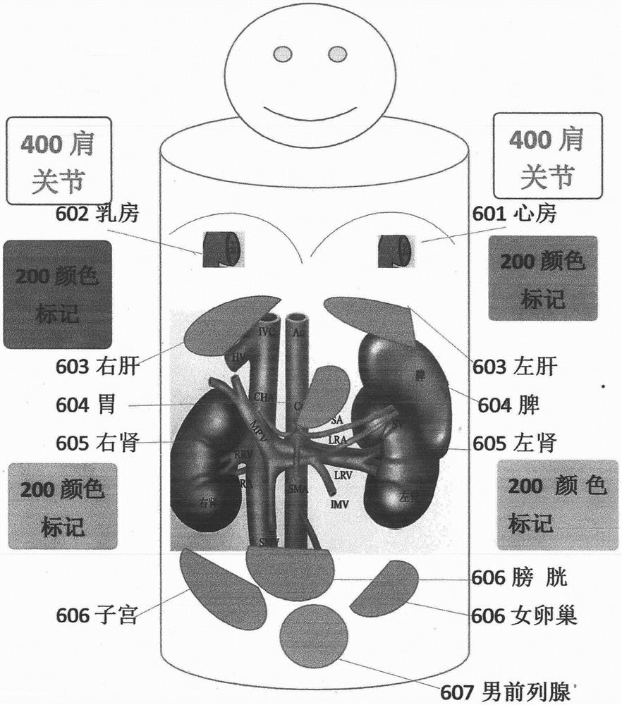 B-ultrasonic data acquisition analysis and diagnosis integrated robot and platform