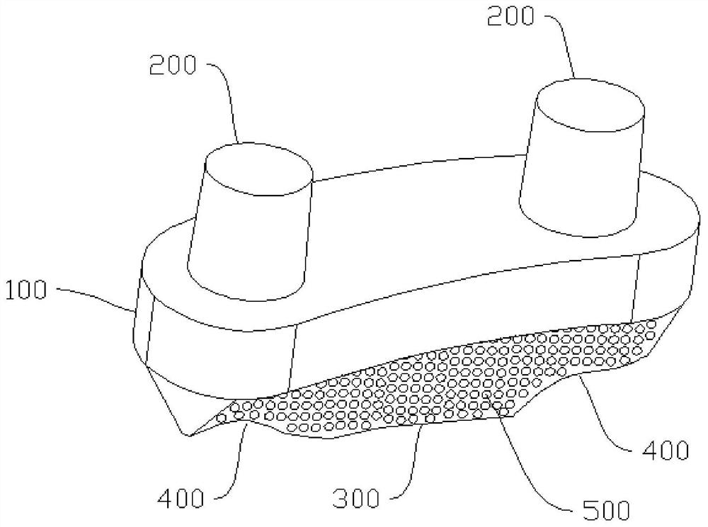 Dental implant and implanting method thereof