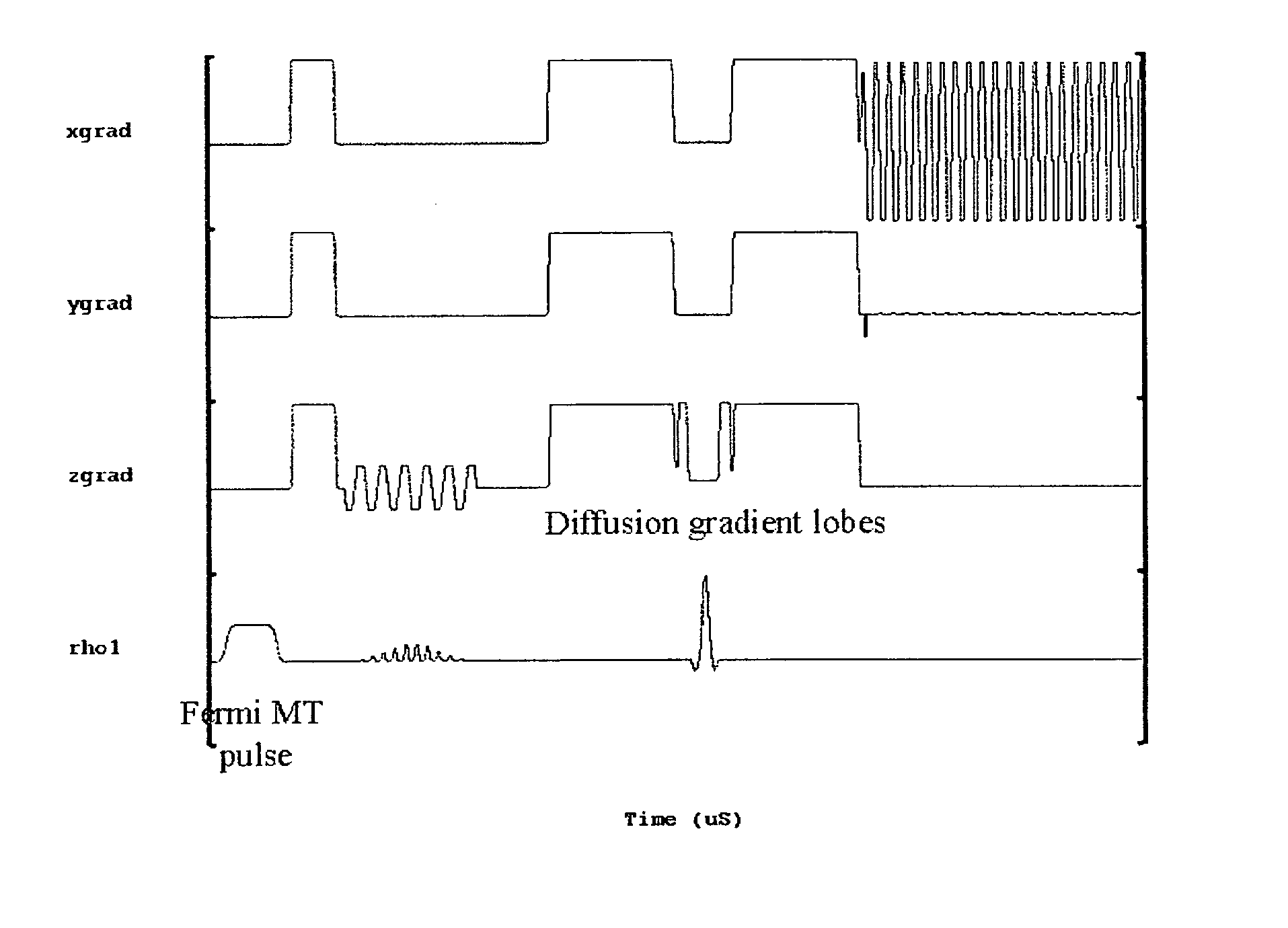 Method for differentiating tissues in magnetic resonance imaging