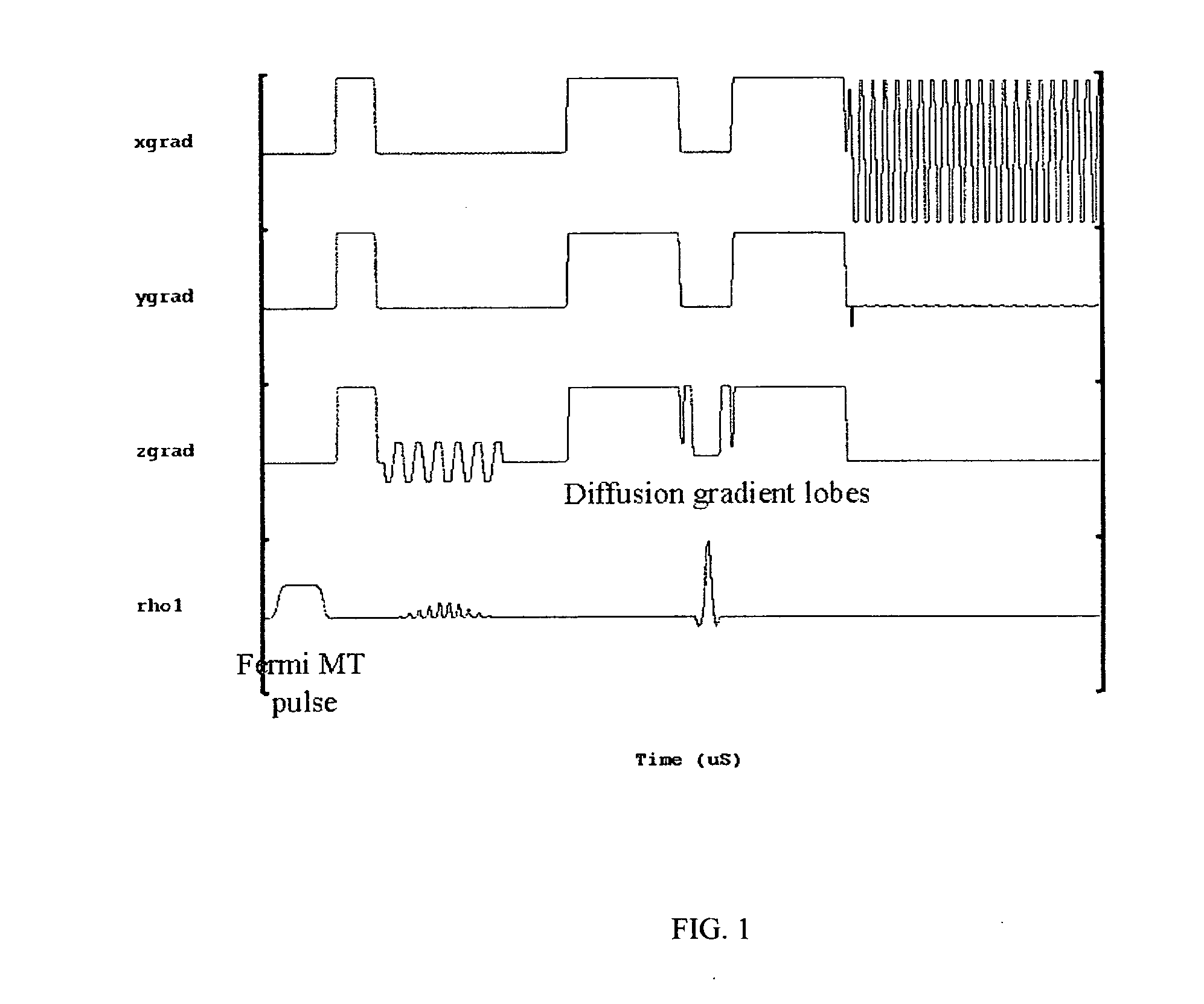 Method for differentiating tissues in magnetic resonance imaging