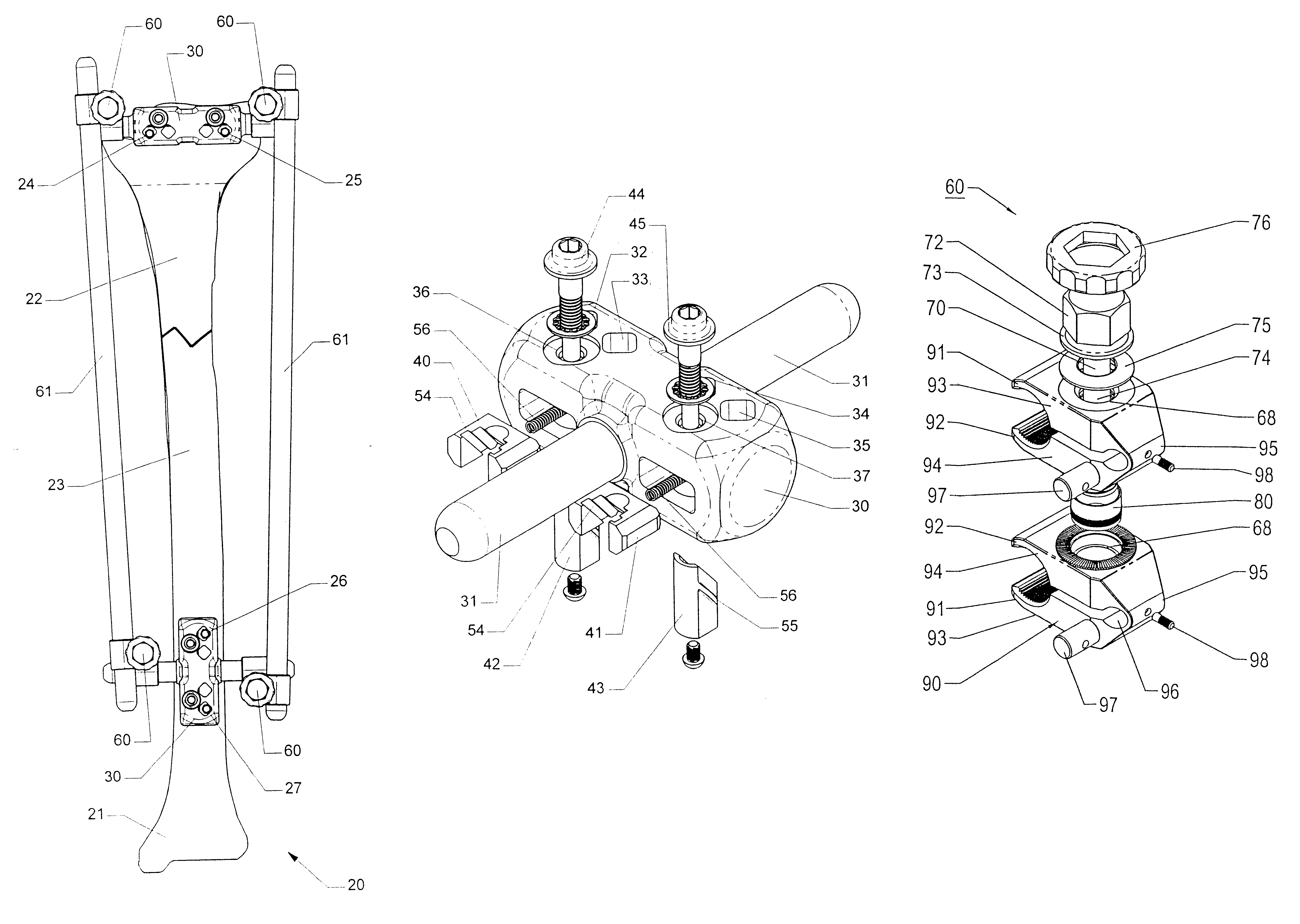 Adjustable bone stabilizing frame system