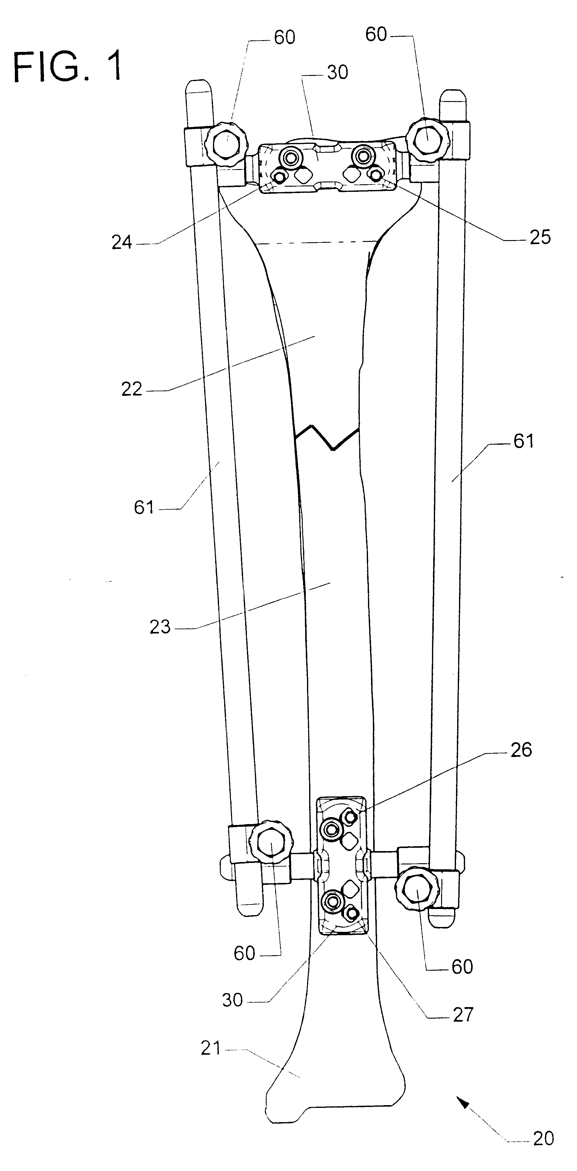 Adjustable bone stabilizing frame system