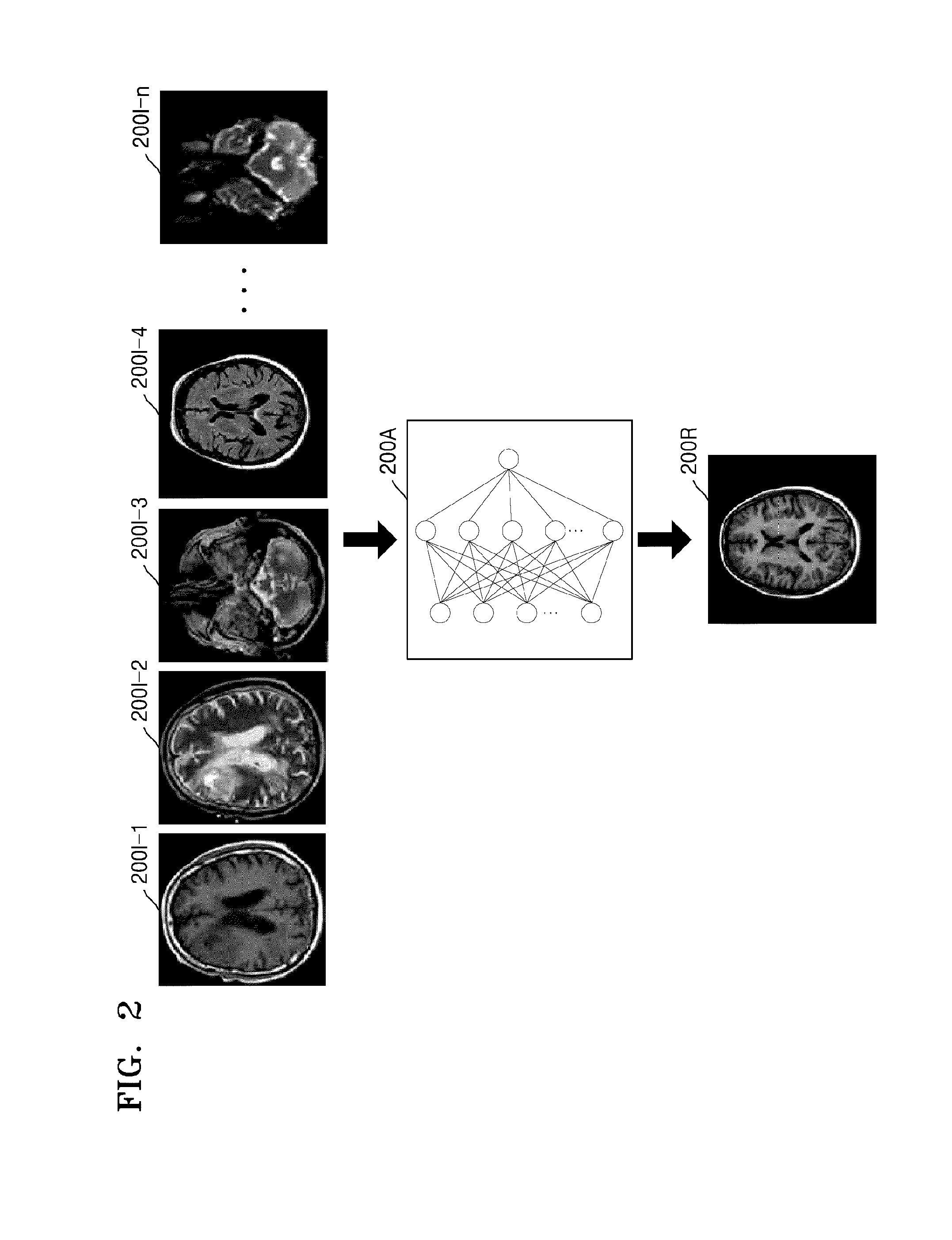 Method and apparatus for processing magnetic resonance image