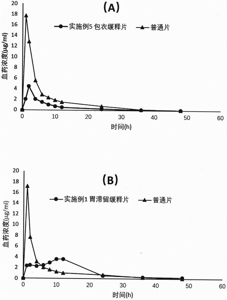 Dexketoprofen Tromethamine Sustained Release Tablets for Gastric Retention