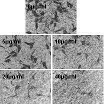 Application of platycodin D to preparation of drug for treating melanoma metastasis