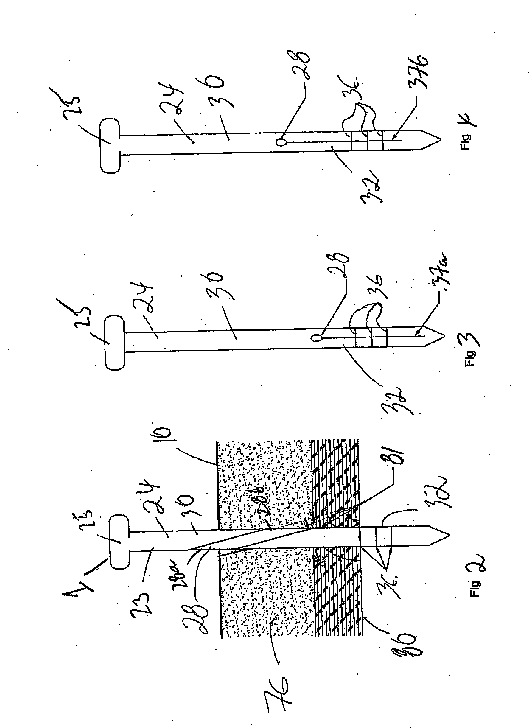 Apparatus and method for laparoscopic port site suture