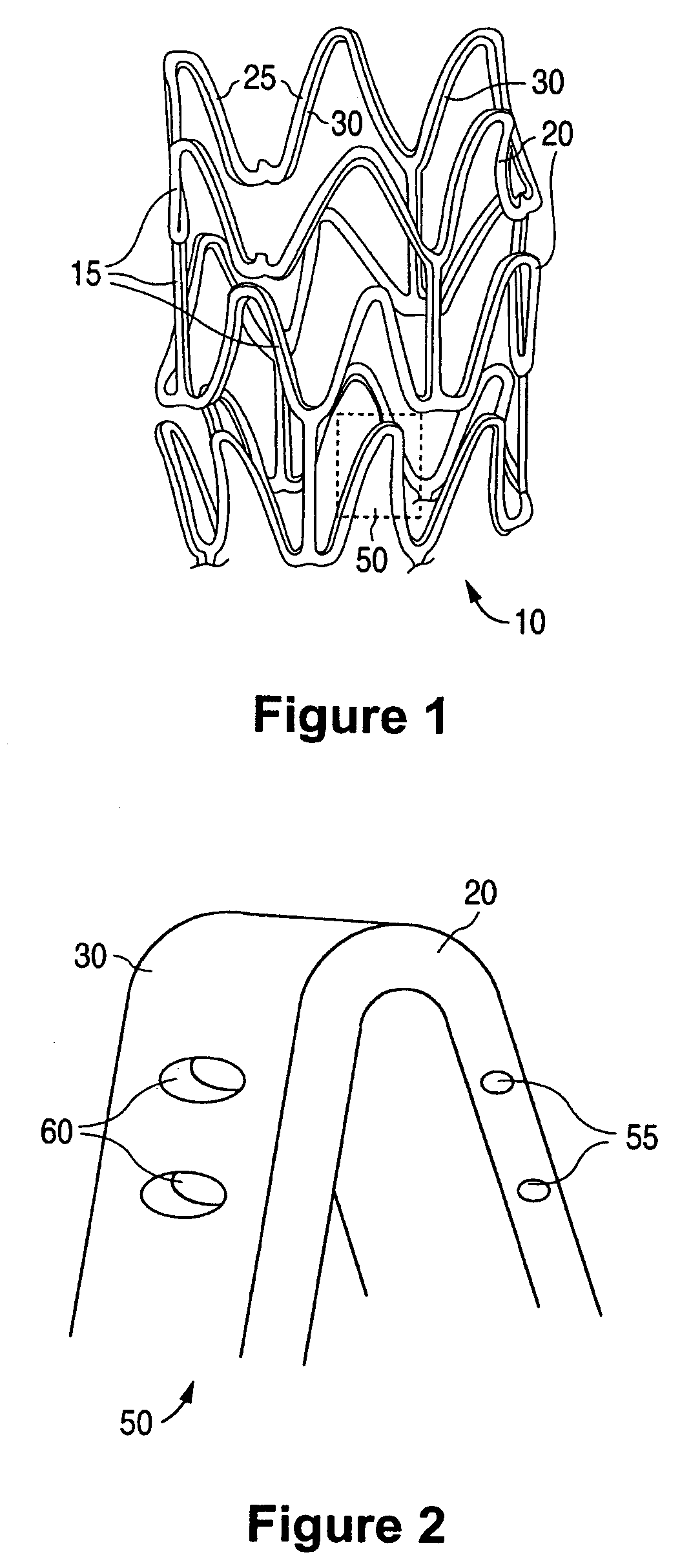 Anti-proliferative and anti-inflammatory agent combination for treatment of vascular disorders with an implantable medical device