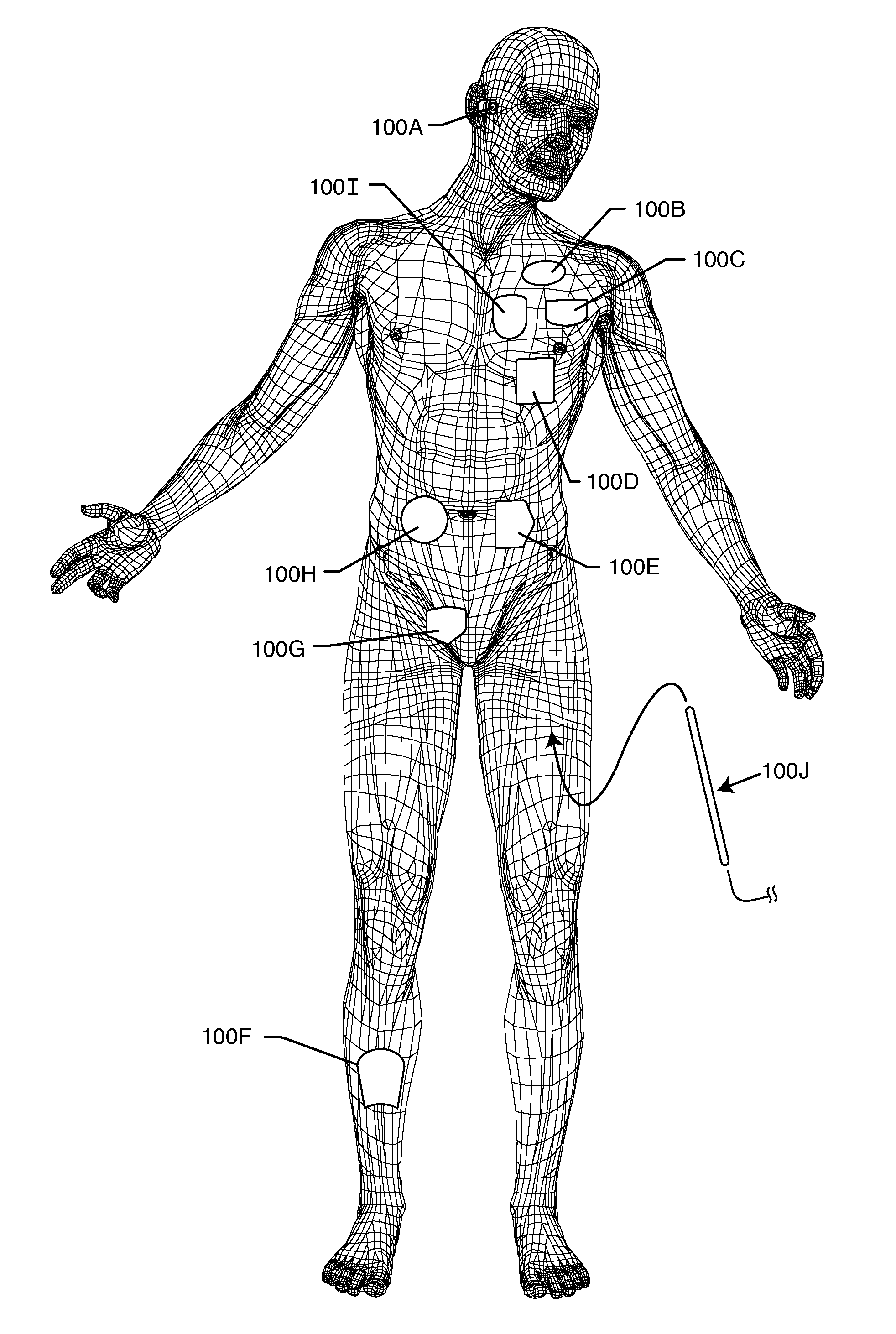 Shielded network for an active medical device implantable lead