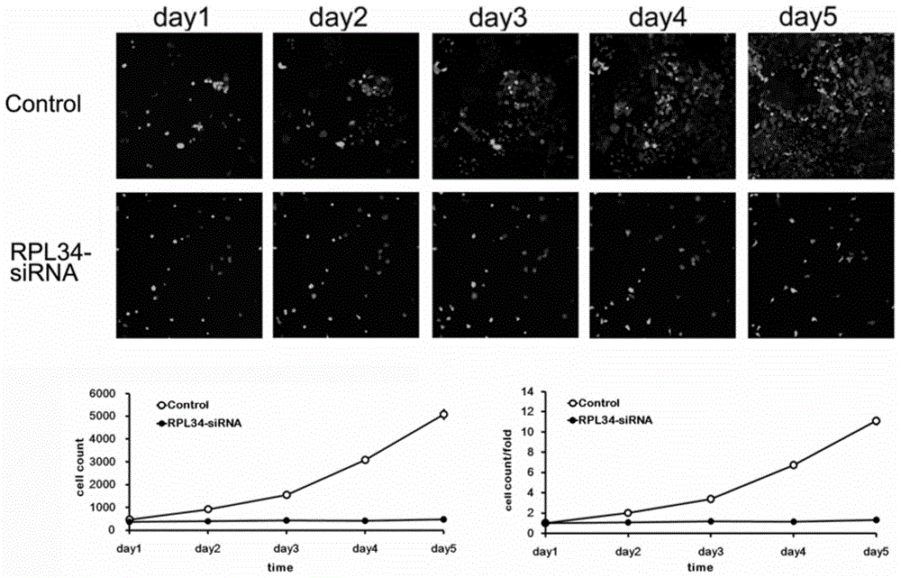 Uses and relevant drugs of human RPL34 (ribosomal protein L34) gene