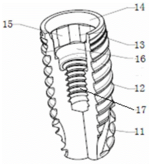 Artificial dental implant, artificial dental implanting system and implanting method