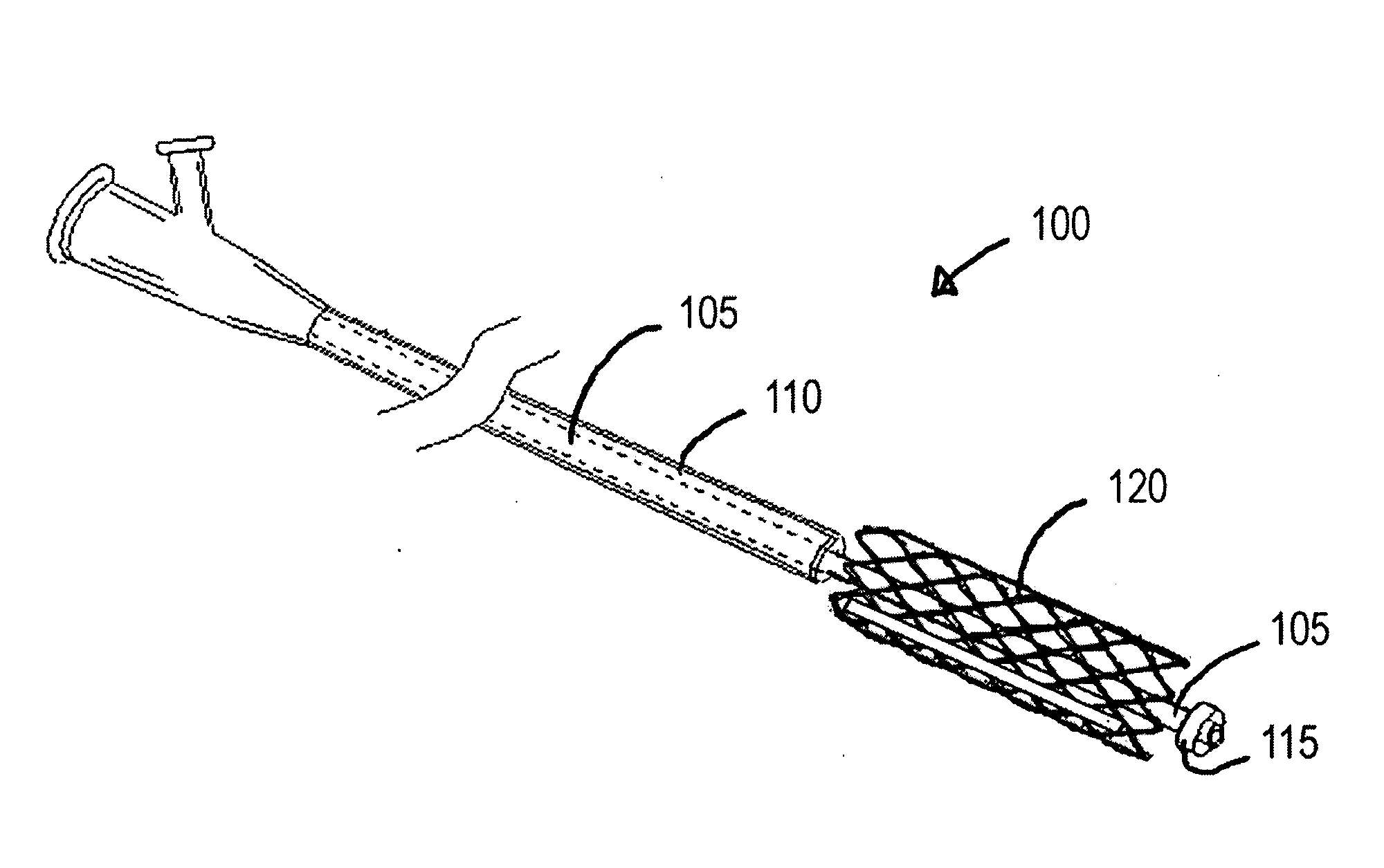 Braided Stent With a Shortenable Tether