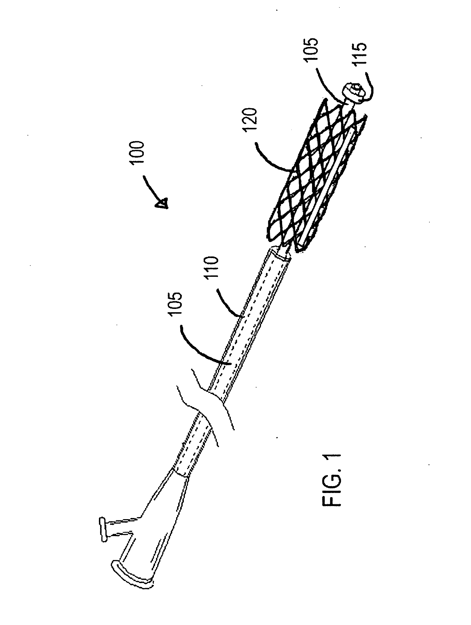 Braided Stent With a Shortenable Tether