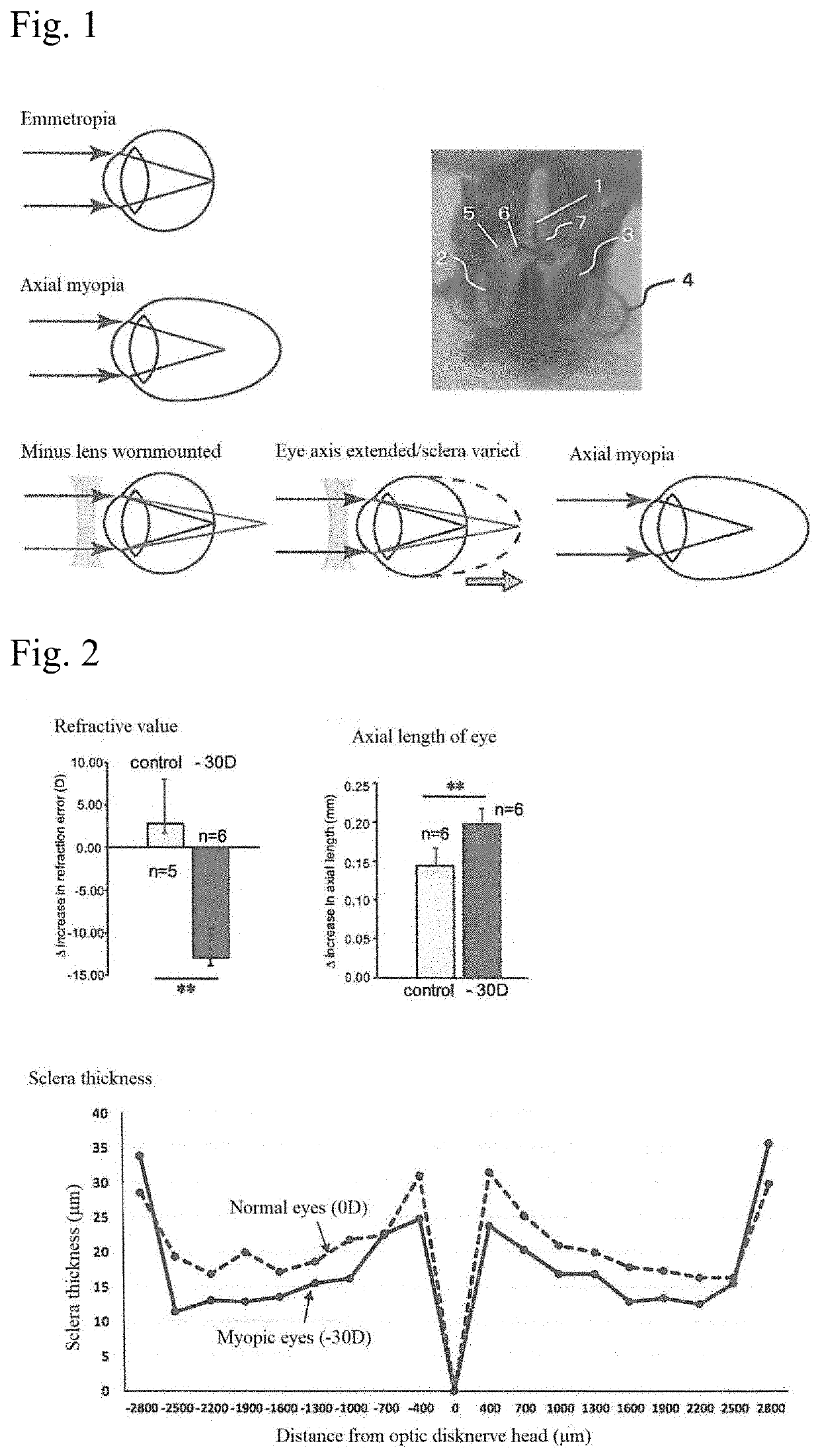 Mouse myopia-induced model and endoplasmic reticulum stress suppressant for preventing and suppressing myopia