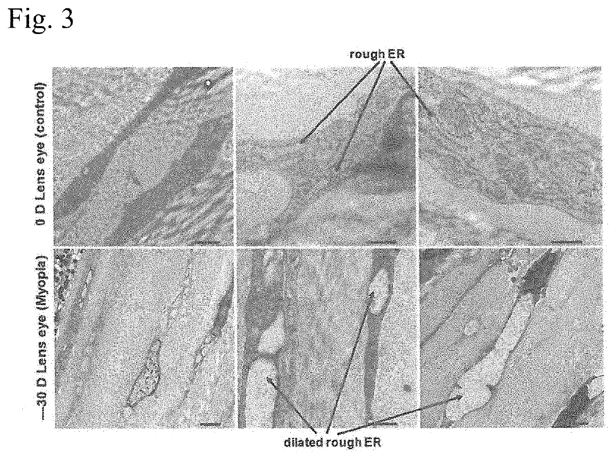 Mouse myopia-induced model and endoplasmic reticulum stress suppressant for preventing and suppressing myopia