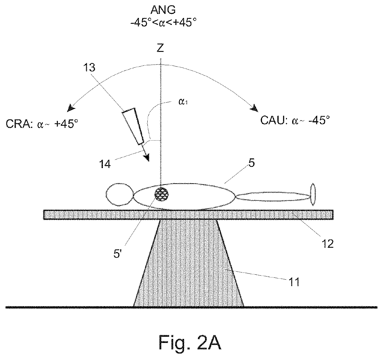 Method and apparatus for reconstructing a three-dimensional representation of a target volume inside an animal or human body