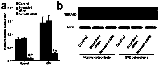 Application of Semaphorin 4D in preventing and treating bone metabolic diseases