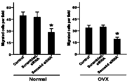 Application of Semaphorin 4D in preventing and treating bone metabolic diseases