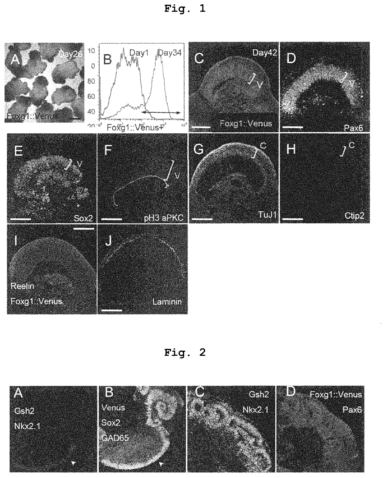 Method for manufacturing telencephalon or progenitor tissue thereof