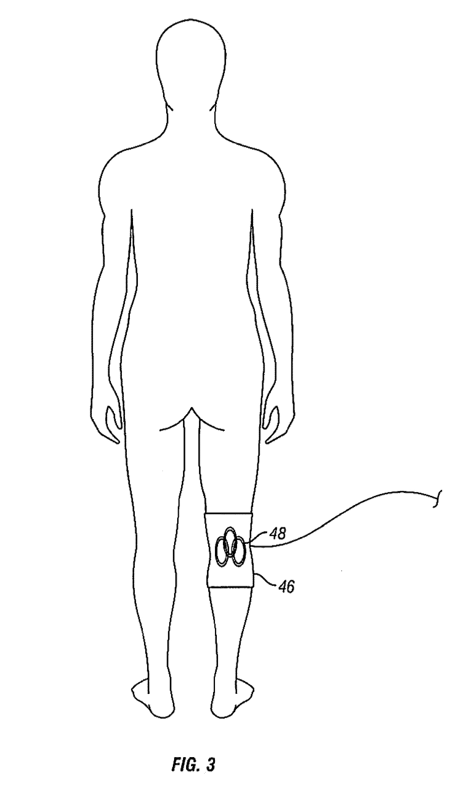 Method and apparatus for magnetic induction therapy