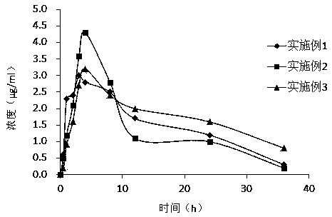 Medicinal composition with etoricoxib and preparation method of medicinal composition