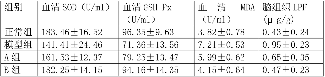 Preparation method of lentinan