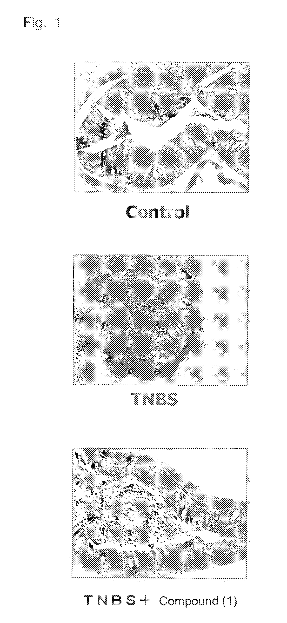 Therapeutic agent for inflammatory bowel disease