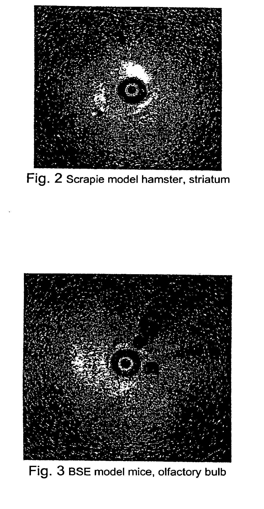 Method for rapid screening of mad cow disease and other transmissible spongiform encephalopathies