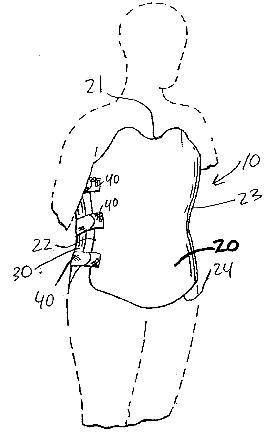 Spinal orthoses